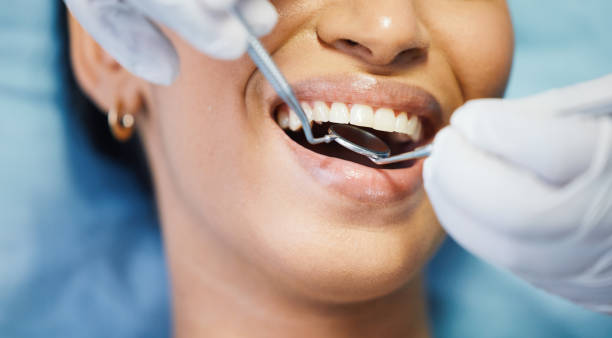 Best Emergency Wisdom Teeth Removal in Enigma, GA